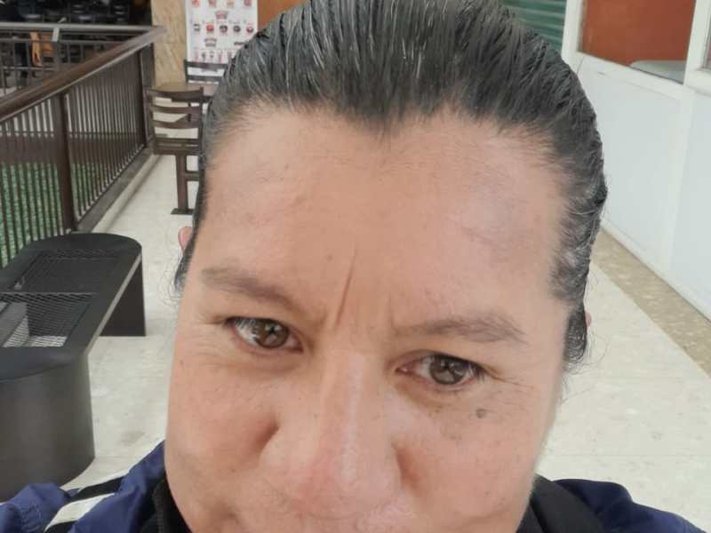 VITRIFICACIÓN DE LA EPOPEYA